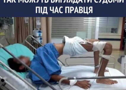 Як виглядають симптоми правця